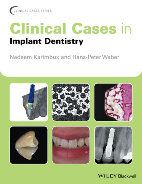 Clinical Cases in Implant Dentistry / Edition 1