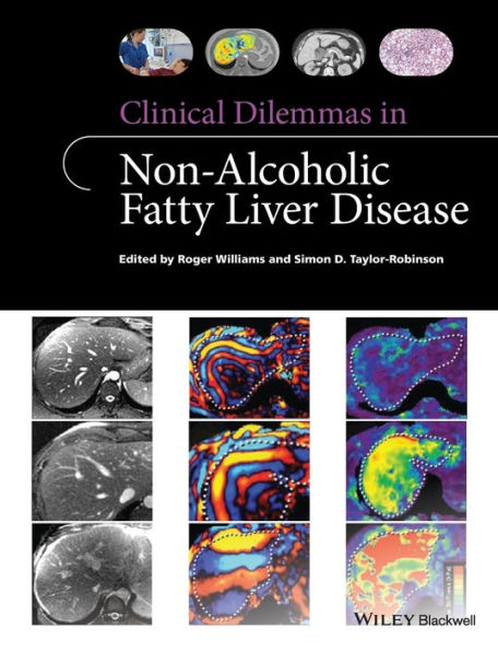 Clinical Dilemmas in Non-Alcoholic Fatty Liver Disease / Edition 1