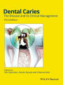 Dental Caries: The Disease and its Clinical Management / Edition 3