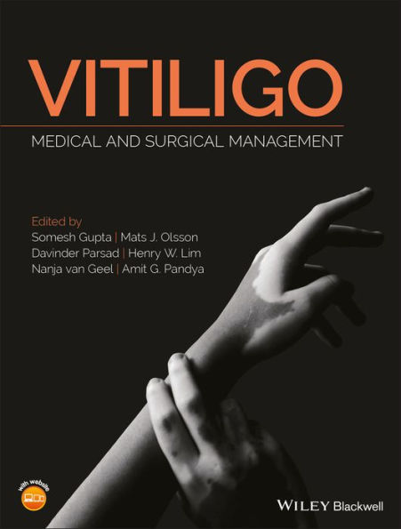 Vitiligo: Medical and Surgical Management / Edition 1