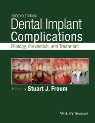 Title: Dental Implant Complications: Etiology, Prevention, and Treatment / Edition 2, Author: Stuart J. Froum