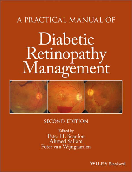 A Practical Manual of Diabetic Retinopathy Management / Edition 2