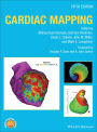 Cardiac Mapping
