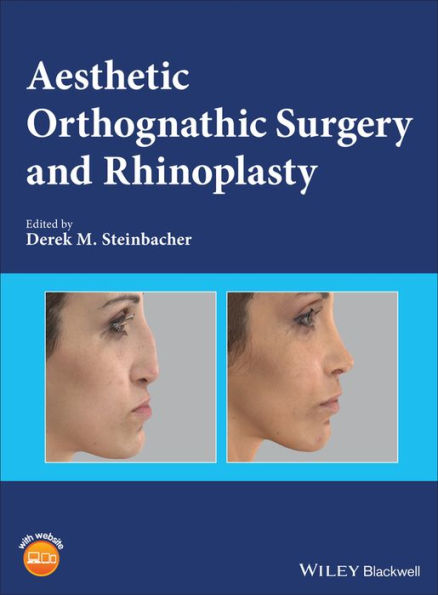 Aesthetic Orthognathic Surgery and Rhinoplasty / Edition 1