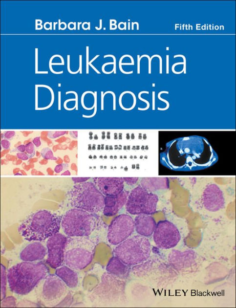 Leukaemia Diagnosis / Edition 5 By Barbara J. Bain | 9781119210542 ...