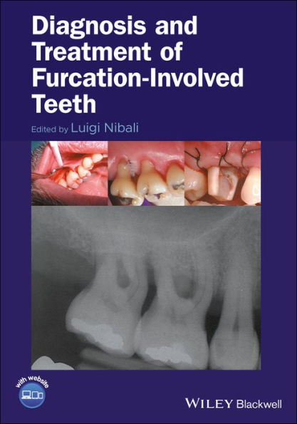 Diagnosis and Treatment of Furcation-Involved Teeth / Edition 1