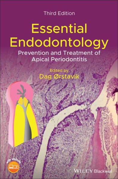 Essential Endodontology: Prevention and Treatment of Apical Periodontitis / Edition 3