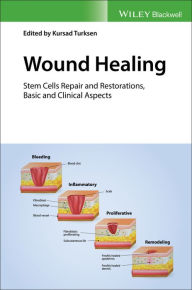 Title: Wound Healing: Stem Cells Repair and Restorations, Basic and Clinical Aspects / Edition 1, Author: Kursad Turksen