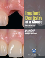 Title: Implant Dentistry at a Glance / Edition 2, Author: Jacques Malet