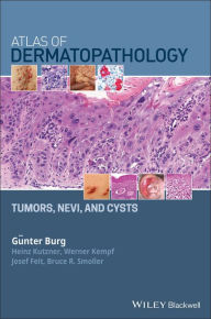 Title: Atlas of Dermatopathology: Tumors, Nevi, and Cysts / Edition 1, Author: Günter Burg