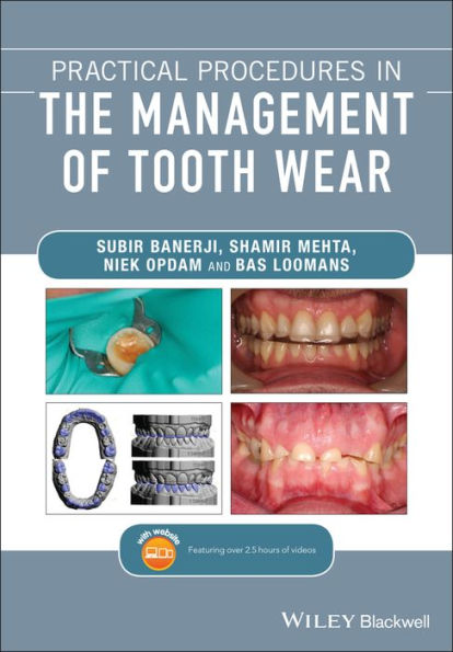 Practical Procedures in the Management of Tooth Wear / Edition 1