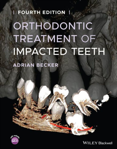 Orthodontic Treatment of Impacted Teeth