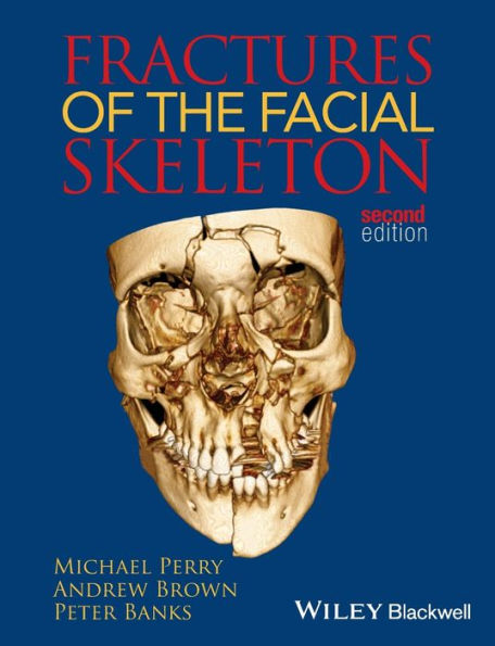 Fractures of the Facial Skeleton / Edition 2