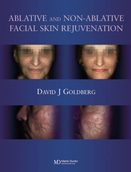 Ablative and Non-ablative Facial Skin Rejuvenation