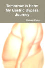 Tomorrow is Here: My Gastric Bypass Journey