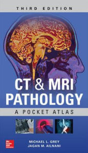 Title: CT & MRI Pathology: A Pocket Atlas, Third Edition / Edition 3, Author: Michael L. Grey