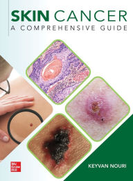 Title: Skin Cancer: A Comprehensive Guide, Author: Keyvan Nouri