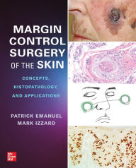 Title: Margin Control Surgery of the Skin: Concepts, Histopathology, and Applications, Author: Patrick Emanuel
