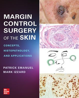 Margin Control Surgery of the Skin: Concepts, Histopathology, and Applications