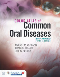 Title: Color Atlas of Common Oral Diseases, Enhanced Edition, Author: Robert P. Langlais