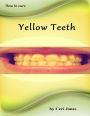 How to Deal With Yellow Teeth