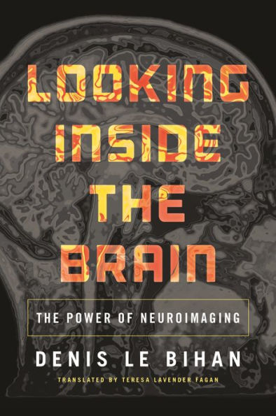 Looking Inside the Brain: The Power of Neuroimaging