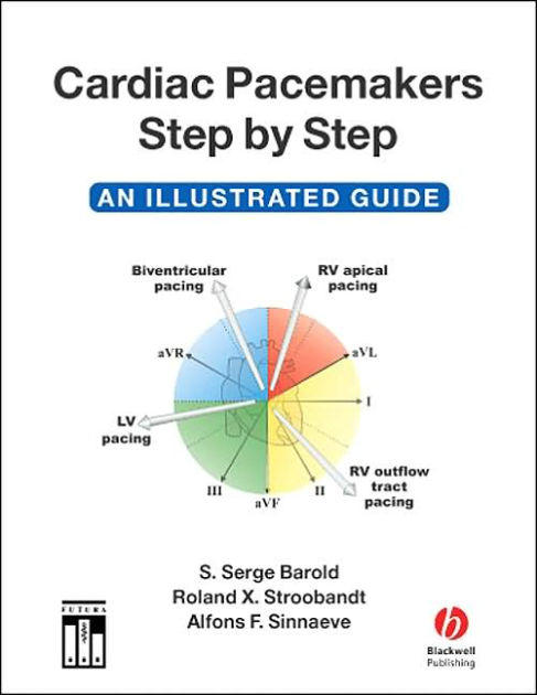 Cardiac Pacemakers Step By Step Free