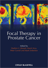 Title: Focal Therapy in Prostate Cancer / Edition 1, Author: Hashim Uddin Ahmed