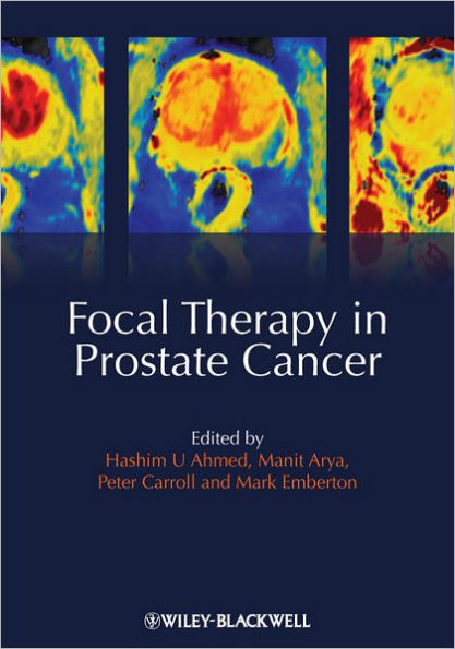 Focal Therapy in Prostate Cancer / Edition 1
