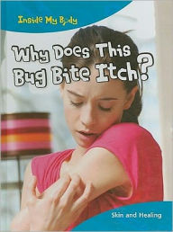 Why Does This Bug Bite Itch?: Skin and Healing