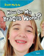 How Do My Braces Work?: Teeth