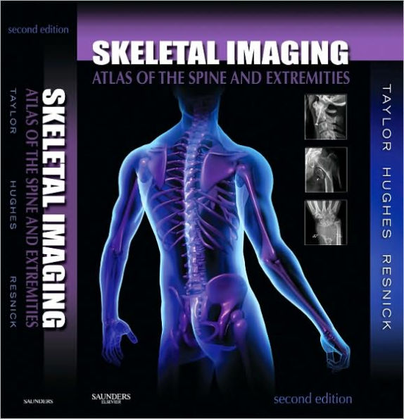 Skeletal Imaging: Atlas of the Spine and Extremities / Edition 2