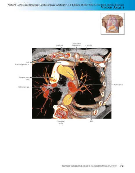 Netter's Correlative Imaging: Cardiothoracic Anatomy