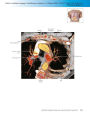Alternative view 2 of Netter's Correlative Imaging: Cardiothoracic Anatomy