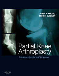 Partial Knee Arthroplasty E-Book: Techniques and Optimal Outcomes - Expert Consult