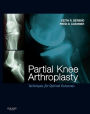 Partial Knee Arthroplasty E-Book: Techniques for Optimal Outcomes with DVD; Expert Consult - Online & Print