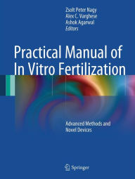 Title: Practical Manual of In Vitro Fertilization: Advanced Methods and Novel Devices, Author: Zsolt Peter Nagy