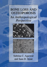 Title: Bone Loss and Osteoporosis: An Anthropological Perspective, Author: Sabrina C. Agarwal