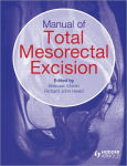 Alternative view 1 of Manual of Total Mesorectal Excision