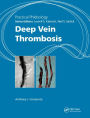 Practical Phlebology: Deep Vein Thrombosis / Edition 1