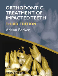 Title: Orthodontic Treatment of Impacted Teeth, Author: Adrian Becker
