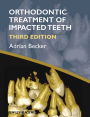 Orthodontic Treatment of Impacted Teeth