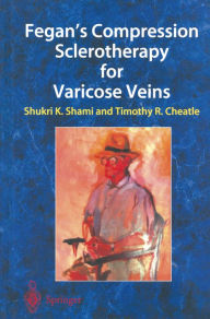 Title: Fegan's Compression Sclerotherapy for Varicose Veins, Author: Shukri K. Shami