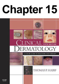 Title: Infestations and Bites: Chapter 15 of Clinical Dermatology, Author: Thomas Habif