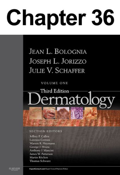 Acne Vulgaris: Chapter 36 of Dermatology