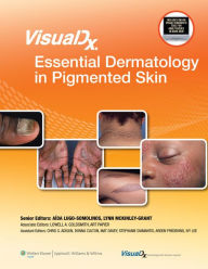 Title: VisualDx: Essential Dermatology in Pigmented Skin, Author: Lowell A. Goldsmith MD