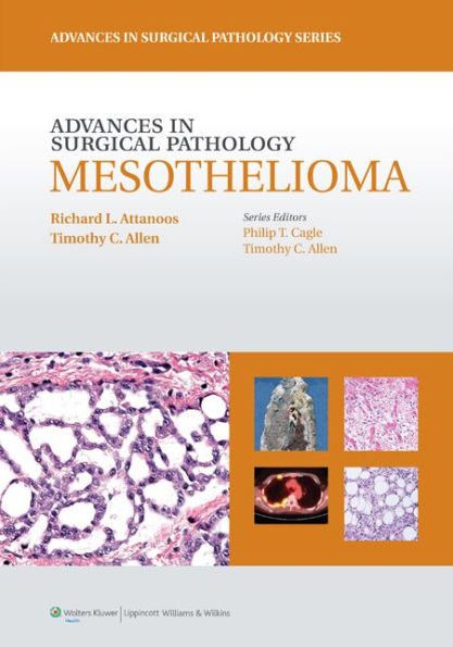 Advances in Surgical Pathology: Mesothelioma