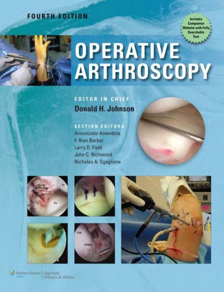 Operative Arthroscopy