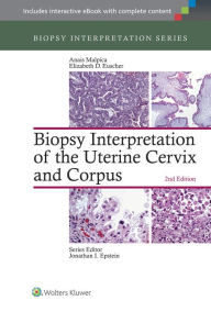 Title: Biopsy Interpretation of the Uterine Cervix and Corpus / Edition 2, Author: Anais Malpica MD