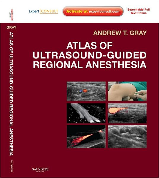 Atlas of UltrasoundGuided Regional Anesthesia Expert Consult Online